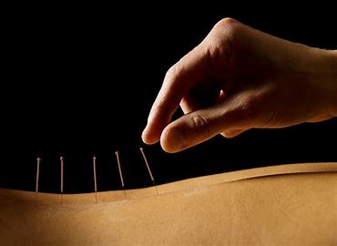Acupuncture for Fertility: Can It Improve Egg Quality & Ovarian Function?