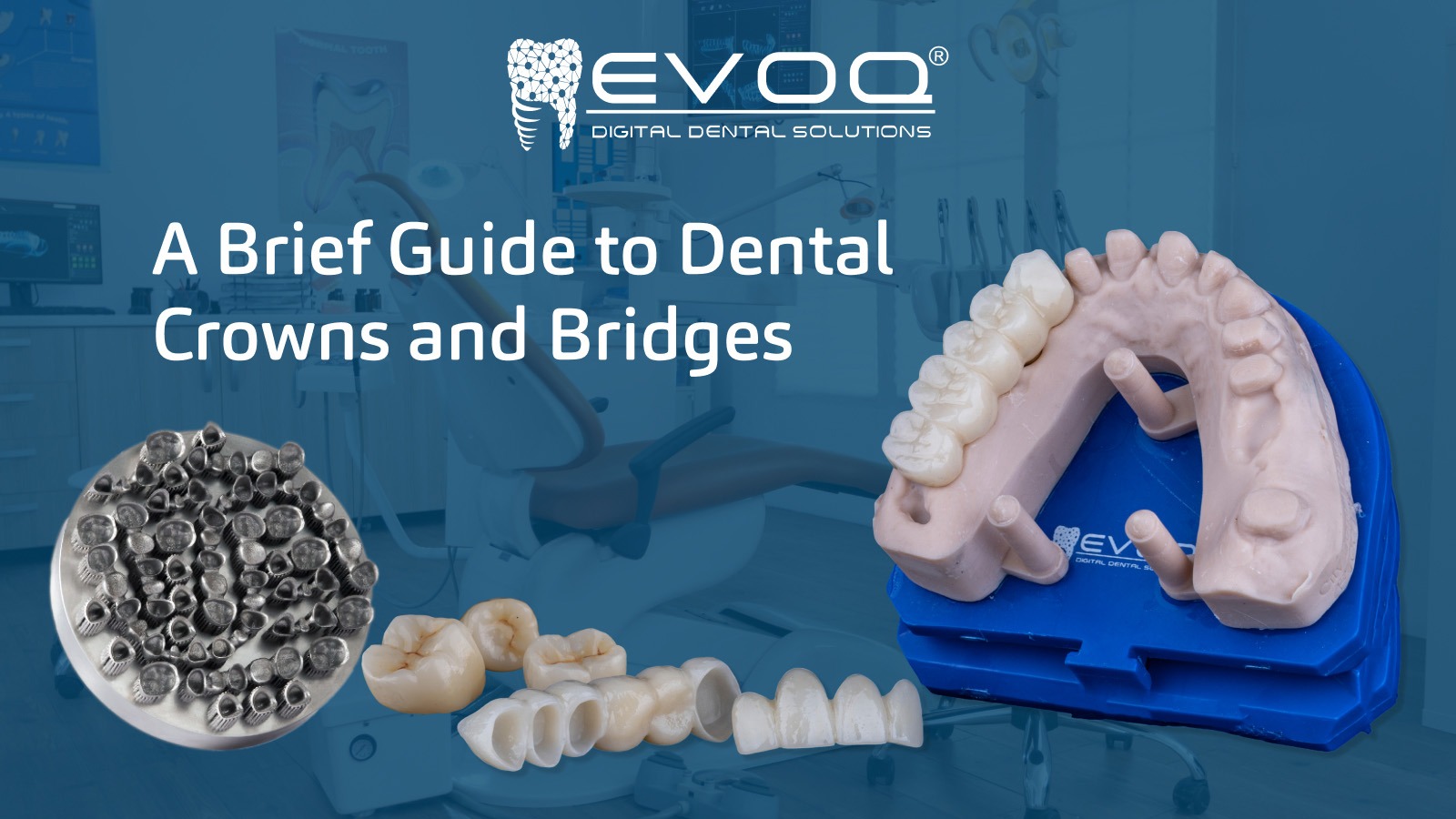 A Quick Guide to Dental Crowns and Bridges - EVOQ Digital Dental Solutions